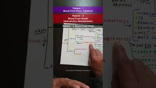 Epistaxis Hematemesis Hemoptysis Hematochezia Melena tcml shorts mbbs [upl. by Angelis]