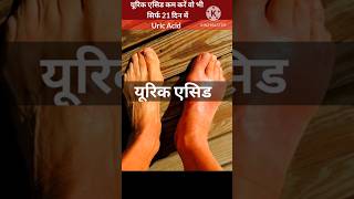 Uric Acid ka ilaj  How to reduce Uric Acid  Uric Acid Treatment shorts short ayurveda ytshort [upl. by Serilda34]