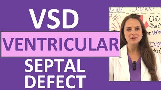 Ventricular Septal Defect Nursing  NCLEX Pediatric Congenital Heart Defects [upl. by Nired]