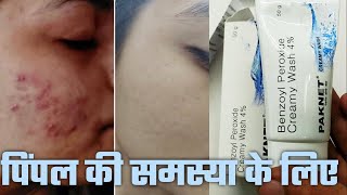 Paknet cream wash uses in hindi benefits PAKNET Benzoyl Peroxide Face Wash pimple acne Paknet [upl. by Auqinahc701]