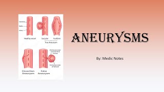 Aneurysms  truefalse Berry aneurysm atheromatous arteriovenous dissecting mycotic syphilitic [upl. by Llezniuq173]