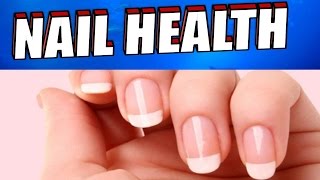 What Your Nails Reveal about Your Health [upl. by Ruthven]