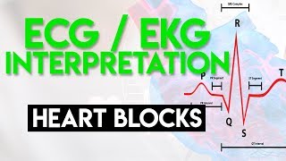 Heart Blocks Made Easy  ECG EKG Interpretation Part 6 [upl. by Reyaht]