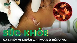 Cập nhật mới về ca nhiễm vi khuẩn Whitmore ở Đồng Nai  SKĐS [upl. by Ardna]