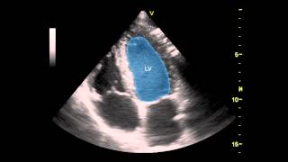 Apical Four Chamber View [upl. by Aicrag]