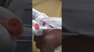 IV Cannulation ivcannulation cannulation bscnursing internship nursing hostellife nishotech [upl. by Viviene]