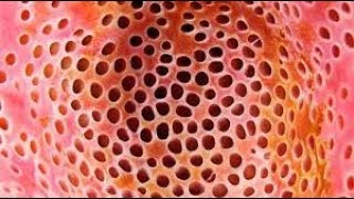 Trypophobia Test 1 [upl. by Shimkus]