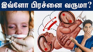 Shaken Baby Syndrome தலை நிக்கல  குழந்தையை கையாள்வது எப்படி  Explained in Tamil [upl. by Ahsilrac]