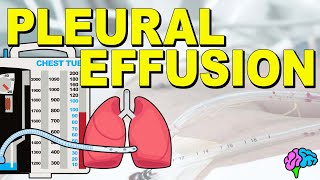 What is a Pleural Effusion EXPLAINED [upl. by Sorrows]