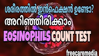 Eosinophils count test malayalam  allergy test  skin disease [upl. by Nylasoj]