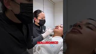 Ácido hialurónico en labios 💋✨ [upl. by Ecadnac]