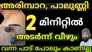 അരിമ്പാറ പാലുണ്ണി 2 മിനിറ്റിൽ അടർന്നു വീഴുംWarts Removal Malayalam Natural Remedy [upl. by Aibonez]