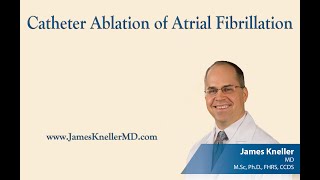 Catheter Ablation of Atrial Fibrillation [upl. by Cire]