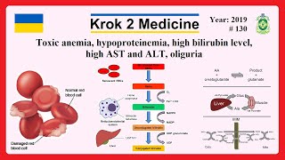 Krok 2 Medicine  Year 2019  130 Ministry of Public Health of Ukraine [upl. by Clance691]