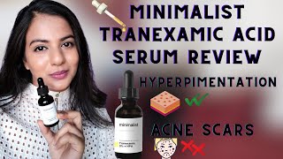 MINIMALIST TRANEXAMIC ACID SERUM REVIEW  Minimalist serum for hyperpigmentation [upl. by Zigrang348]