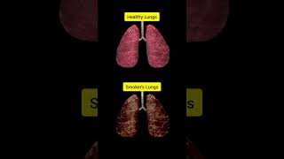 Healthy Lungs VS Smokers Lungs human health smoke [upl. by Mahalia]