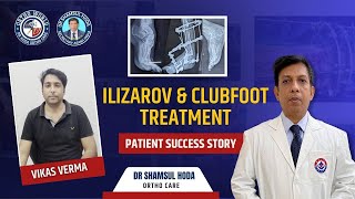 Vikash Vermas Ilizarov amp Clubfoot Treatment Success Story with Dr Shamsul Hoda [upl. by Wolbrom433]