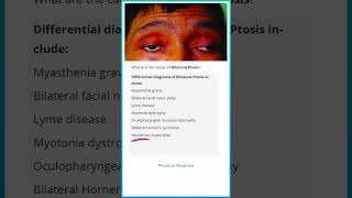 Causes of Bilateral Ptosis [upl. by Nwahsit]