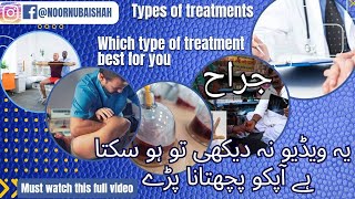 which types of treatment are best for you ll Detailed video ll ExPhysiologist [upl. by Trude]