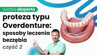 SPOSOBY REKONSTRUKCJI BEZZĘBIA PROTEZA CZY MOST NA IMPLANTACH CO WYBRAĆ [upl. by Adnylem166]