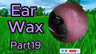 ear wax removal asmr animation [upl. by Iman485]