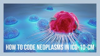 CODING NEOPLASMS IN ICD10CM [upl. by Bicknell]