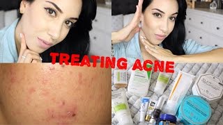 Daily Skin Care Routine ♥ Get Rid Of Acne amp Scars [upl. by Ilenna]