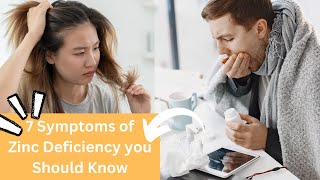 7 Symptoms Of Zinc Deficiency You Must Know [upl. by Yunfei]