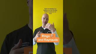 Why Raynauds Makes Wearing Rings Challenging [upl. by Lorola]