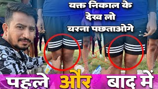 85 प्रतिशत  लोगो को होगी SSCGD में ये समस्या 😳 Knock knee problem है तो कैसे बचे मेडिकल में ☑️ [upl. by Lejna401]