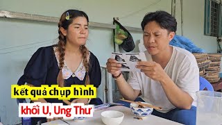 Sự Thật Về Khối U Trong Ổ Bụng Của Vợ Thái Có Phải Là Ung Thư   DuyNisa [upl. by Larimer]