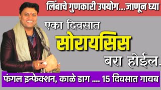 उष्णता एका दिवसात कमी करा  Dr Swagat Todkar  gharguti upchar घरगुती उपाय [upl. by Atiuqihc]