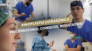 RINOPLASTIA ULTRASONICA  Preoperatorio consejos resultados [upl. by Sethi]