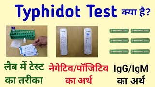 Typhidot test  Typhoid test  typhidot igm igg positive means in hindi [upl. by Ecnaralc498]