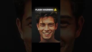 Chico Lachowski edit 🤫  Popular  TheWeeknd chico mog edit looksmaxxing mewing theweeknd fyp [upl. by Japeth119]