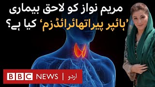 Maryam Nawaz Can Hyperparathyroidism Be Treated Only in US and Switzerland  BBC URDU [upl. by Nuawad]