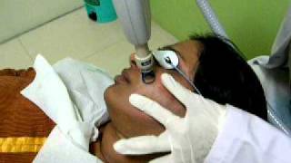 Fractional Erbium YAG Laser Treatment for Acne Scars  Dr Rinky Kapoor [upl. by Hahsia984]