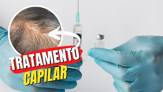 Tratamento Capilar com Intradermoterapia e MMP [upl. by Ailhat]