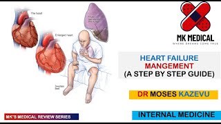 Heart failure Management [upl. by Silvanus]