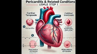 PericarditisCardiac tamponadePericardial effusionUSMLE STEP 1 Review [upl. by Tibbitts]