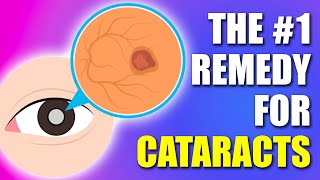 1 REMEDY for Cataracts in 2024 Updated [upl. by Ellevehs]