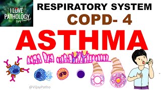 Chronic Obstructive Pulmonary Disease Part 4 Asthma  Etiopathogenssis amp Pathology [upl. by Iteerp]