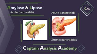 E2acute pancreatitis Amylase amp Lipase انزيمات البنكرياس الاميليز والليبيز [upl. by Katuscha]