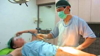 Liposuction with DrArthur [upl. by Nayrda]