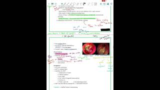 Atticoantral disease unsafe CSOM ENT EAR SERIES [upl. by Leahcimal]