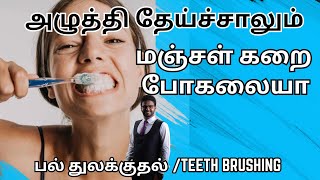 சரியான முறையில் பல் துலக்குவது எப்படி𝐇𝐨𝐰 𝐭𝐨 🅱🆁🆄🆂🅷 🆈🅾🆄🆁 🆃🅴🅴🆃🅷 𝐩𝐫𝐨𝐩𝐞𝐫𝐥𝐲 𝐢𝐧 𝐭𝐚𝐦𝐢𝐥𝐓𝐚𝐦𝐢𝐥 𝐡𝐞𝐚𝐥𝐭𝐡 𝐭𝐢𝐩𝐬 [upl. by Allyn]