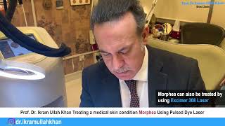 Morphea No More Pulsed Dye Laser Therapy Unveiled for Treatment morpheatreatment lasermachine [upl. by Klarrisa327]