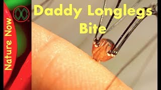 Daddy Long Legs  Myth or Legend [upl. by Gauntlett]