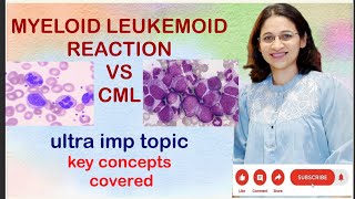 LEUKEMIACML vs LEUKEMOID REACTION VIMP topic for ugpg neetpg inicet pathologyconcepts [upl. by Beisel117]