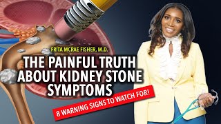 The Painful Truth About Kidney Stone Symptoms 8 Warning Signs to Watch For [upl. by Gilliam]